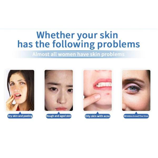 Small Size Hydrafacial Machine / Water Diamond Dermabrasion Aqua Facial Machine