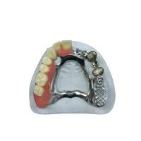 Belle apparence Précision Prêtement Prothèse Prêtement Implant