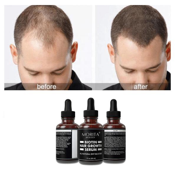 Glass Bottle ISO Hair Regrowth Ginger Serum Anti Hair Loss Care Repairing