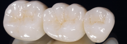 1200 Mpa A3.5 CAD CAM Zirconia Pre Shaded Blocks With Brightness Values