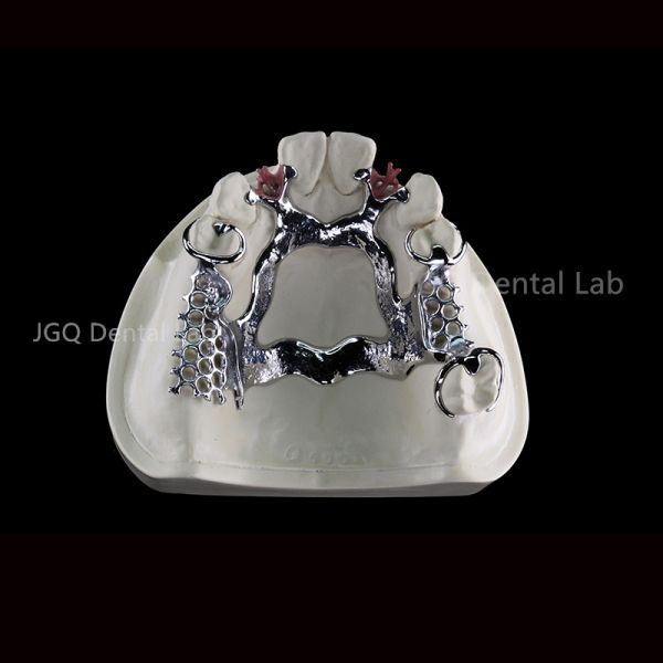 3D Printing Co Cr Alloy Removable Denture Framework Customized for Oral Restoration