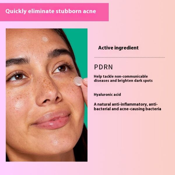 Single Sided Painless Microneedle Acne Patch Microcrystals Water Activated PE Adhesive Sticker for Masking Use
