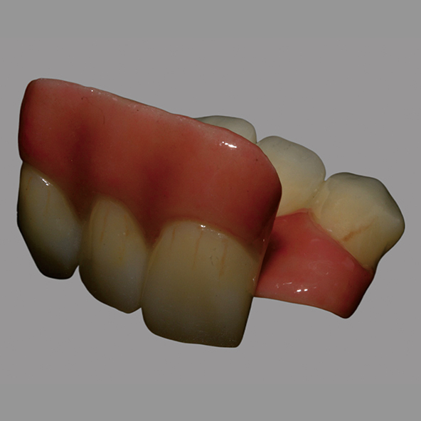 Digital Design Dental Lab | CAD / CAM Dental Layered Zirconia Bridge With Pink Porcelain