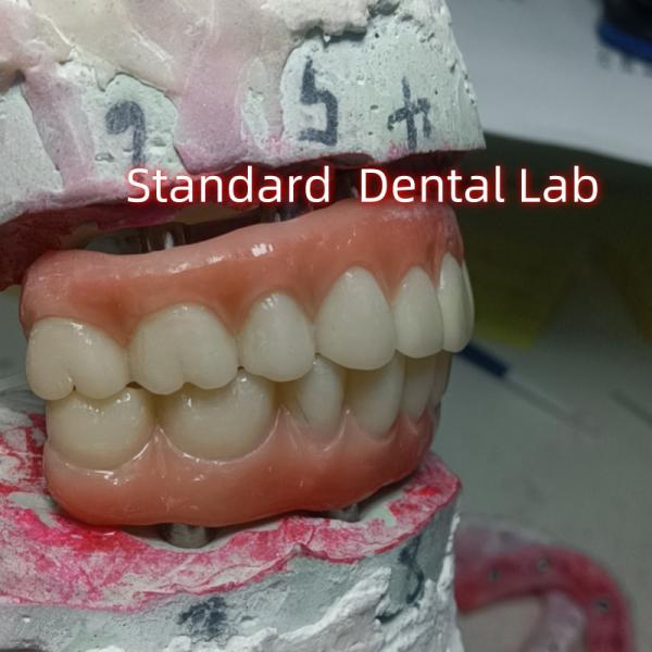 Зубной имплантат Временная корона ПММА мост с розовым фарфором