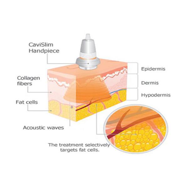 Ultrasonic Vacuum 32k Cavitation Slimming Machine Skin Tightening