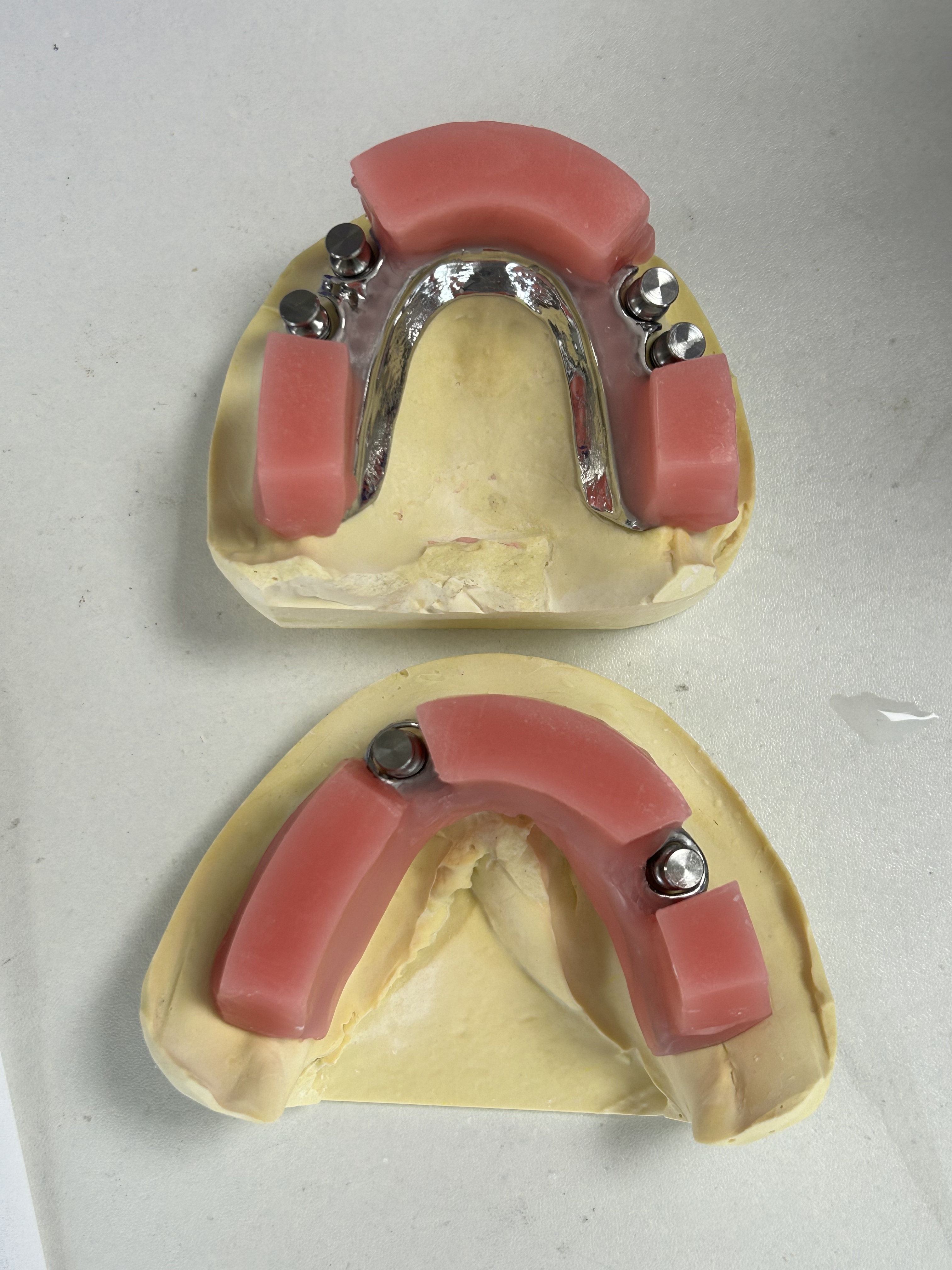 Remmovable Dental Prosthetics