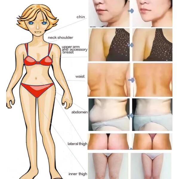 Впрыска Mesotherapy красная Lipo нестрогая липолитическая уменьшая