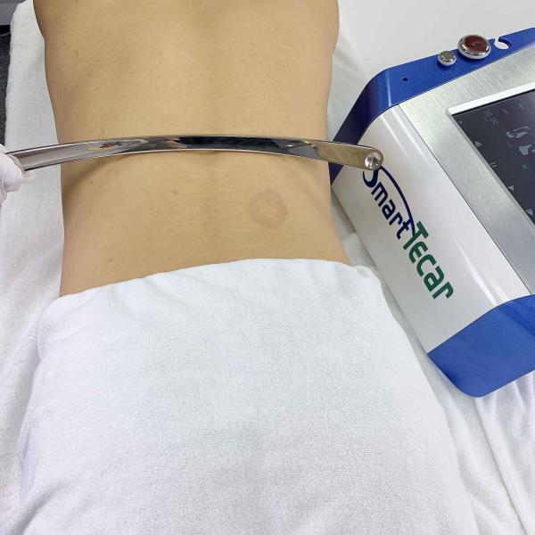60mm Chiropractic Physio Spine Pain And Sport Injury Tecar Physical Therapy Machine