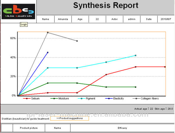 Hot!!! CE qualified best quality boxy skin and hair analyzer