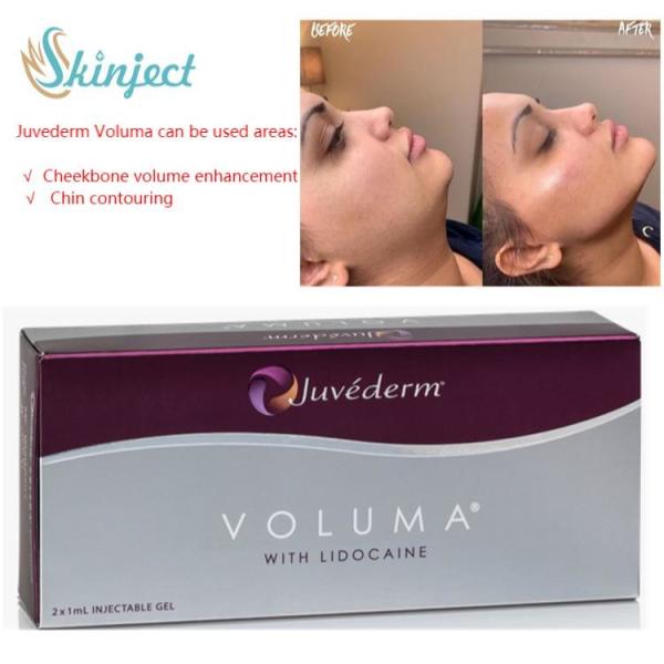 Face Care 2x1ml Juvederm Lip Fillers Hyaluronic Acid Dermal Injectable