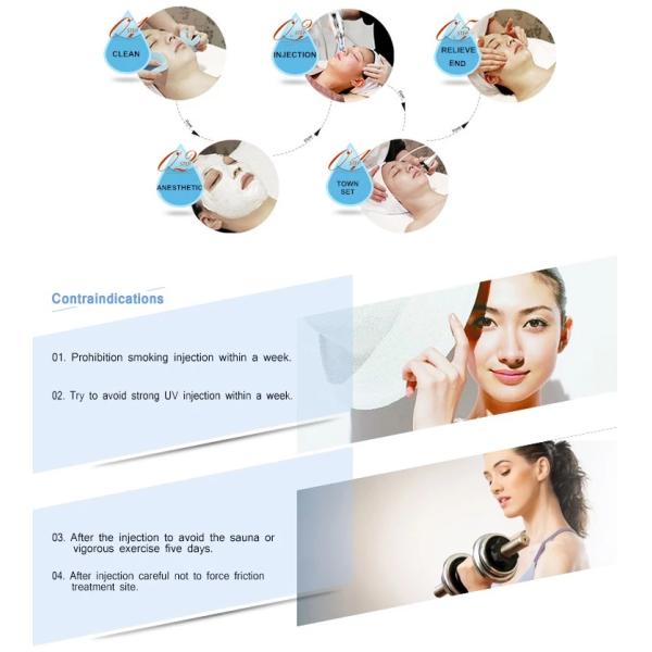 Шприц впрыски заполнителя OEM стерильный Hyaluronic кисловочный дермальный