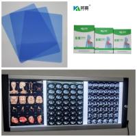 Sortie 280gsm X médical Ray Film Inkjet Blue Base pour l'image IRM 10x12 11x14 A4 A3 de DR CT