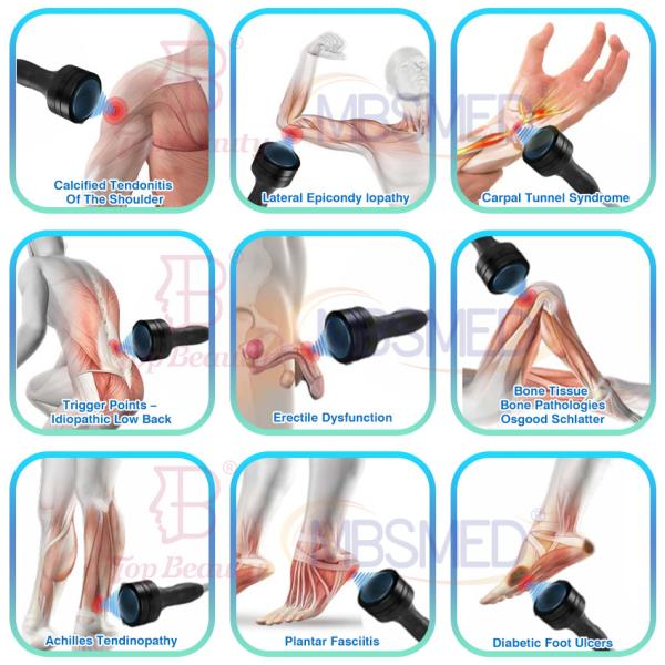 Electromagnetic Focused Shockwave Therapy Focus Shock Wave Fisioterapia Equipment