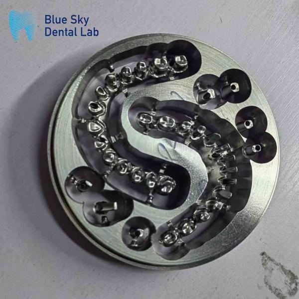 Шрубы удержаны MUA опоры Имплантантные корпуса Циркониевые короны Многослойный розовый фарфор с легким ремонтом