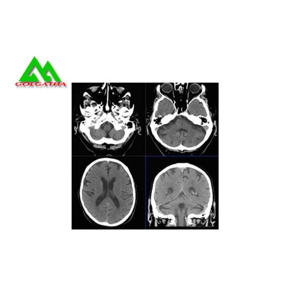 High Sensitivity Medical X Ray Film X Ray Room Equipment Accessories All Size