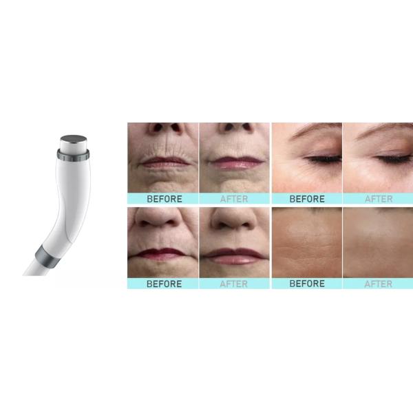 Laser OPT SHR Nd Yag IPL Hair Removal Machine 3 In 1 480nm 530nm For Salon