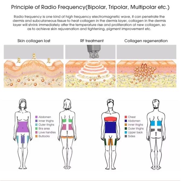 Cryolipolysis portatif amincissant la machine, grosse machine de congélation de liposuccion de salon