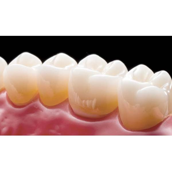 A1 High Translucent Multi Layer Zirconia Blank D98*12mm For Open CAD CAM System