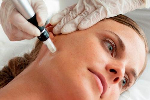 12 / Machine à la maison électronique de beauté d'utilisation de 32 bornes, stylo de rouleau de Derma de retrait de ride