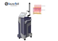 OEM fracionário do ODM da máquina do laser do CO2 das marcas de estiramento da acne