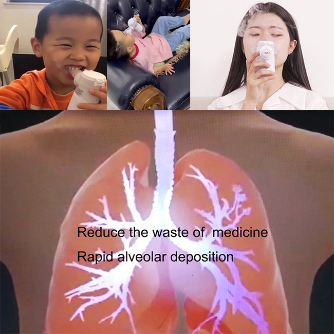 Портативная обработка 2.7μm машины Nebulizer дома Budesonide для детей педиатрических