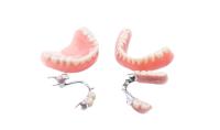 Dentaduras Removíveis Invisíveis Preenchidas Implantes Dentários Temporários