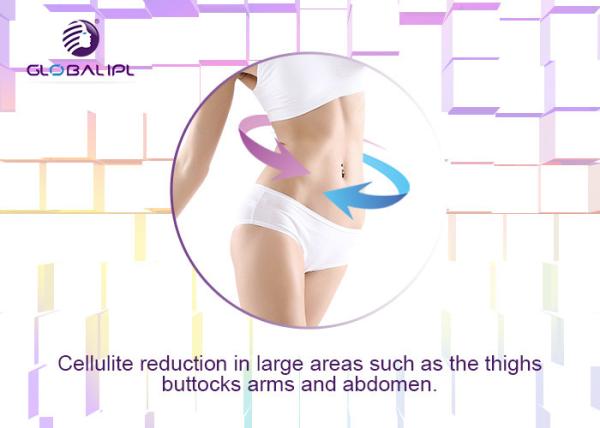 RF Cellulite Melting Cavitation Lipo Laser Slimming Machine For Man And Woman