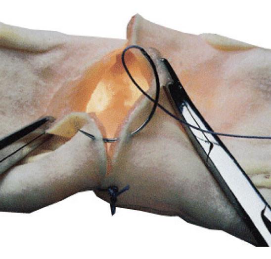 Clinical Skills Training Intestinal Anastomosis simulator with intestinal canal