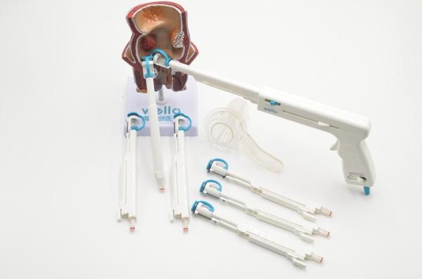 White Rubber Band Ligation Of Internal Hemorrhoids , No Foreign Body Remain Rubber Band For Piles