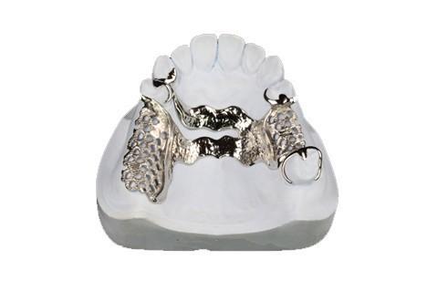 High Purity Titanium Partial Dentures Surface Polishing And Anti Bacterial Spot