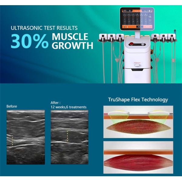 Тело Trusculpt для похудения Монополярная радиочастотная машина 2 в 1 Flex Trushape Id Flex