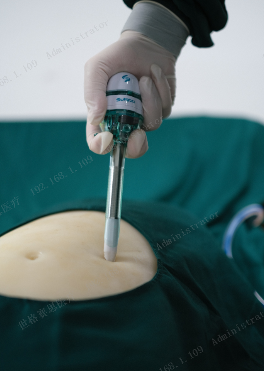 Surgsci 5 мм безлопастый трокар Лапароскопические приборы одноразовый трокар 5 мм