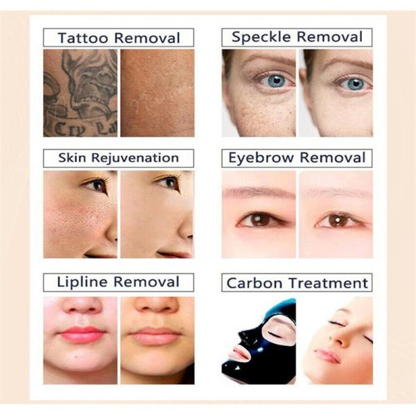 Multifunctional Portable Diode Laser Hair Removal Machine 1064nm 532nm 755nm