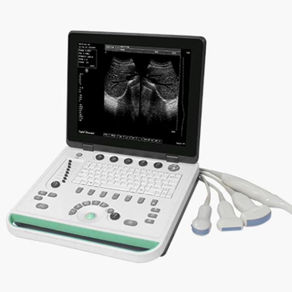 Ultrasound Machine For Veterinary / Human Sonostar Portable Laptop Ultrasound Machine
