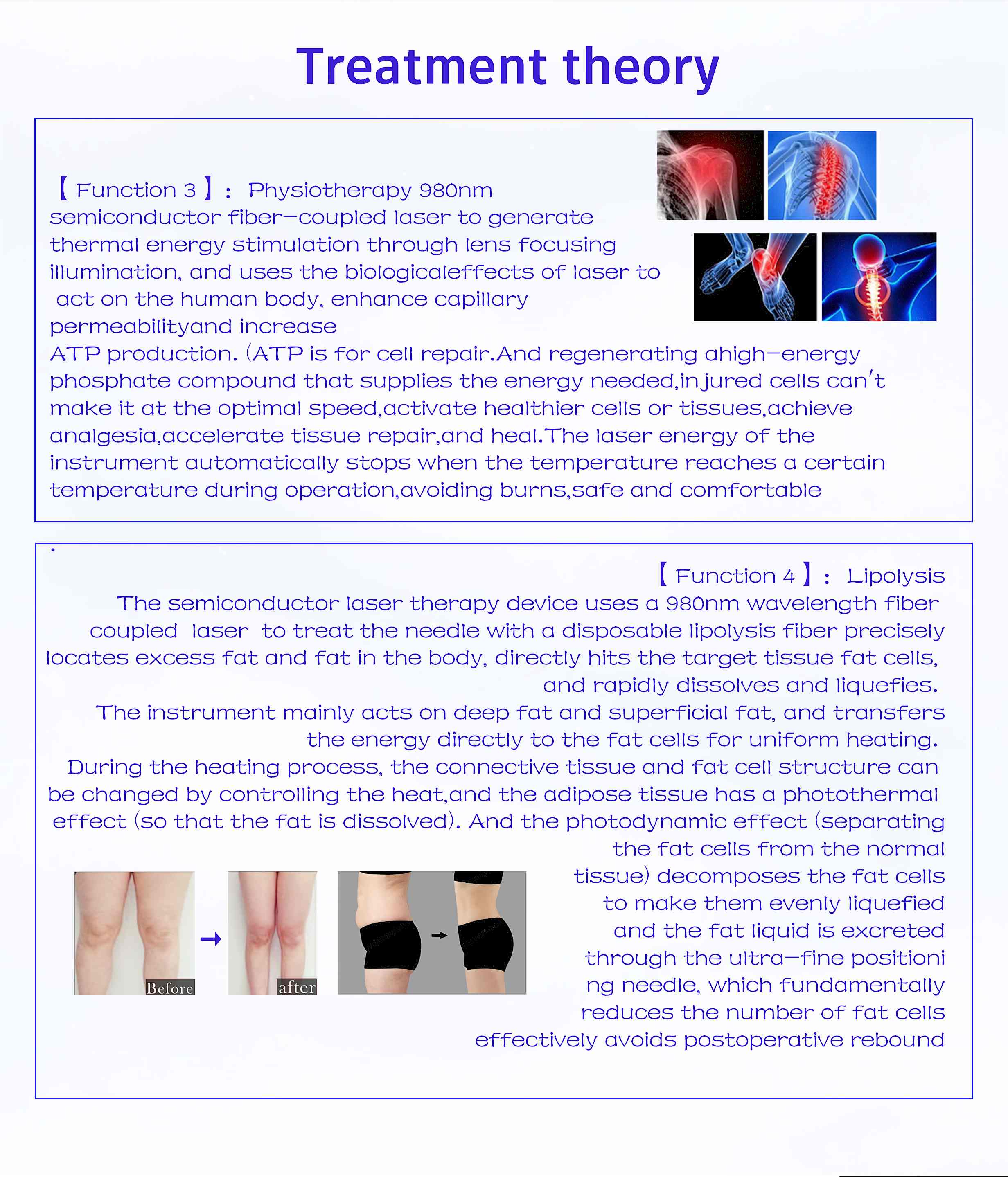Compact Desktop Laser Beauty Machine with 980nm Diode Laser for Vascular Lesion Removal Nail Fungus Treatment PainRelief and Lipolysis Therapy