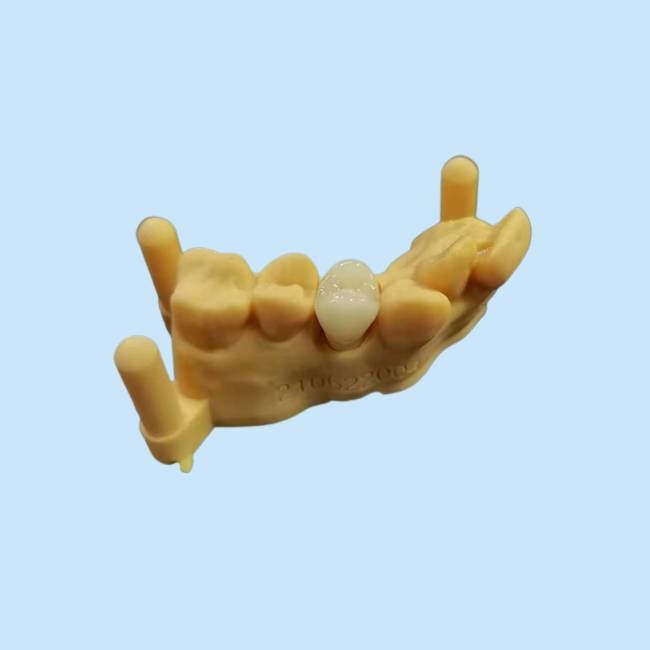 OEM 3D печатая дизайн цифров лаборатории гибкого акрилового Denture зубоврачебный
