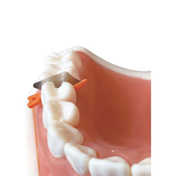 Dental Sectional Matrix System Wedge Guards M3 3.0