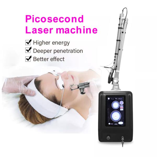 Laser tattoo removal q-switched nd:yag laser carbon peel/Q switched nd yag laser /tattoo removal beauty machine