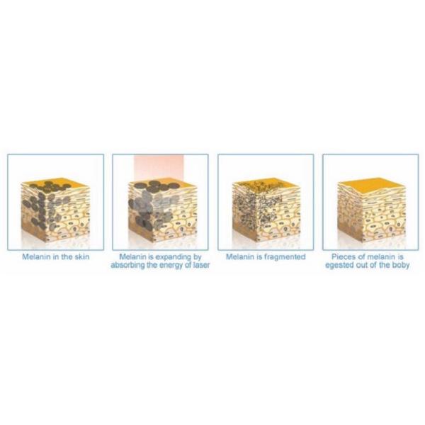 4 In1 808NM Hair Removal Diode Laser Tattoo Removal Q Switched Nd Yag Laser IPL 755 808 1064nm Machine