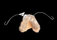 Activateurs orthodontiques polyvalents: la solution ultime pour l'alignement et la croissance de la mâchoire