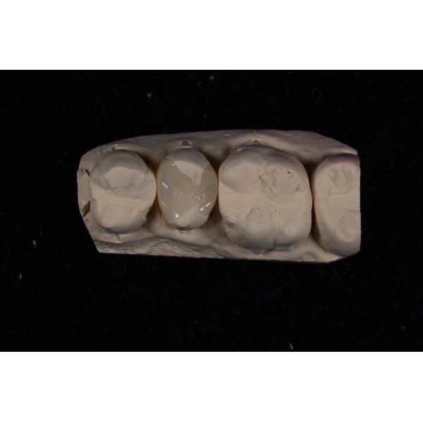 Прочность Керамические фанеры Emax Crown с отличной стойкостью к пятнам / биосовместимостью