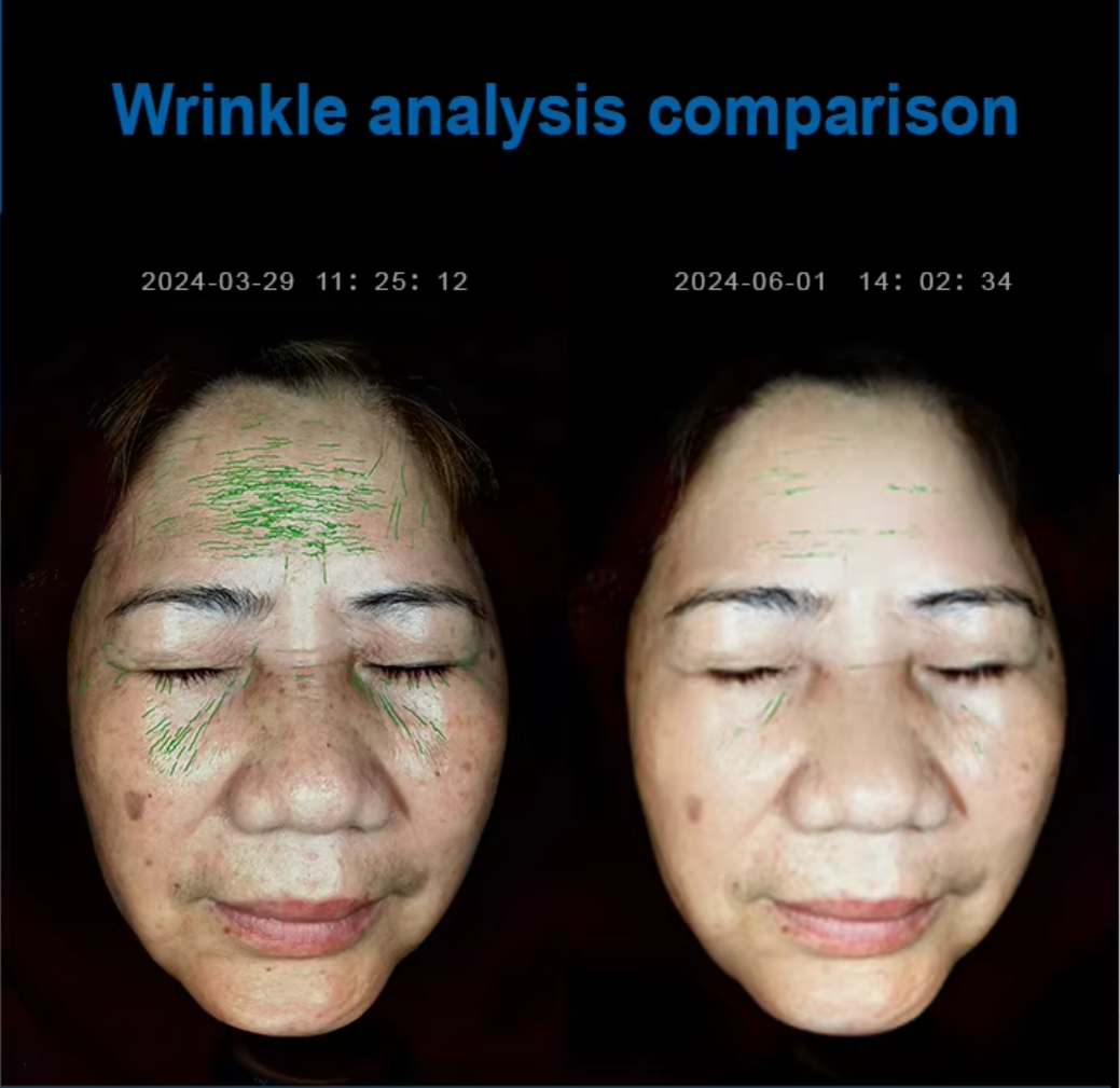12 Spectrum Skin Analysis Machine , AI Facial Skin Scanner Analyzer Diagnosis Machine