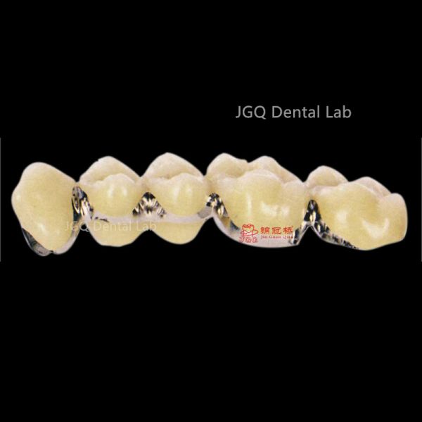Porcelain Fused to Metal Crown and Bridge Made in China Dental Lab