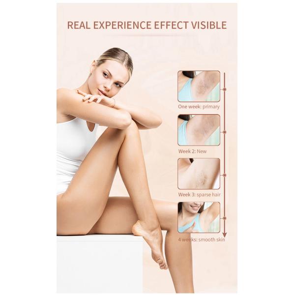50W Permanent Home Laser Hair Removal Device