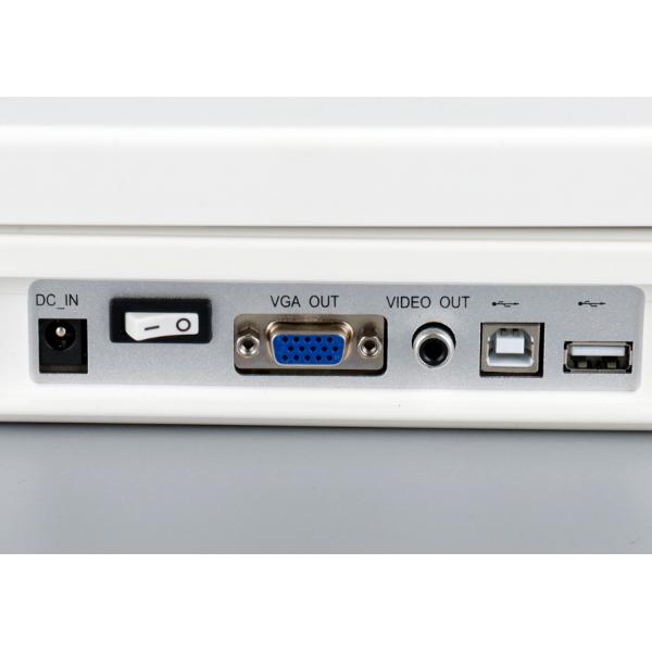 Black&white Portable Medical Ultrasound Scanner Machine for Vet Use