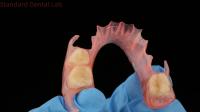 Modelo de impresión 3D Dental TCS Valplast Flexibles Dentaduras Parciales Color Rosa / Oscuro Producto de laboratorio dental