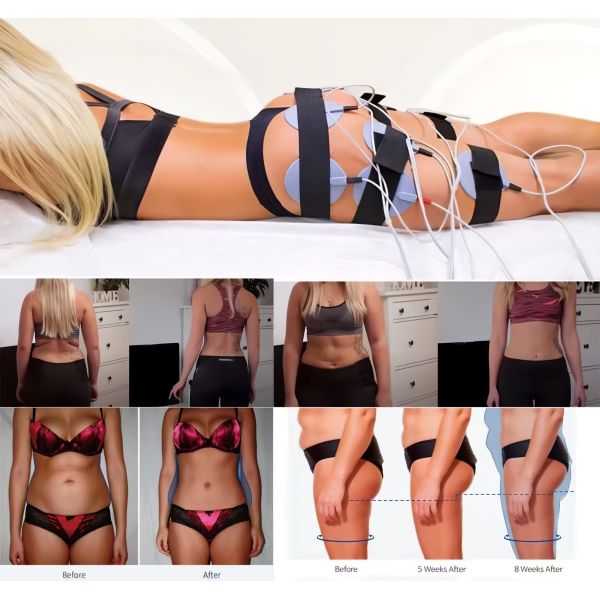 60W EMS Slimming Machine , Electronic Muscle Stimulation Equipment