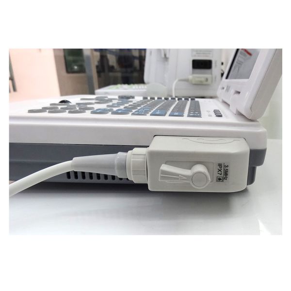 GH-500 Laptop Ultrasound Scanner Convex Probe Ultrasound Diagnostic Equipment