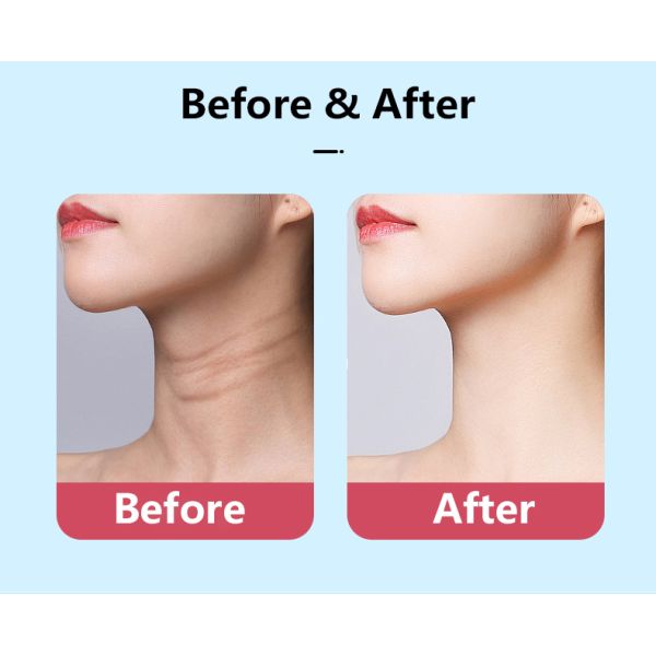 Facial Microcurrent EMS Neck Face Lifting Massager Multi-function Beauty Eqiupment