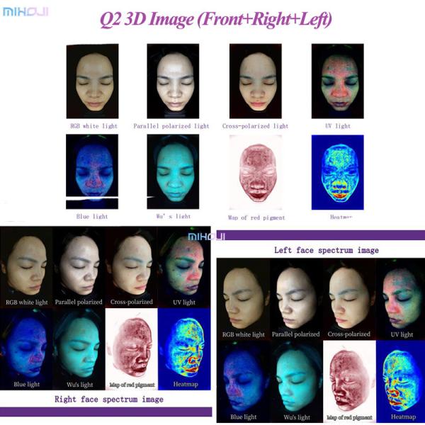 1pc Camera 4D Skin Analysis Machine Pigmentation Analysis For Beauty Salons